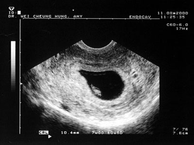 Baby years